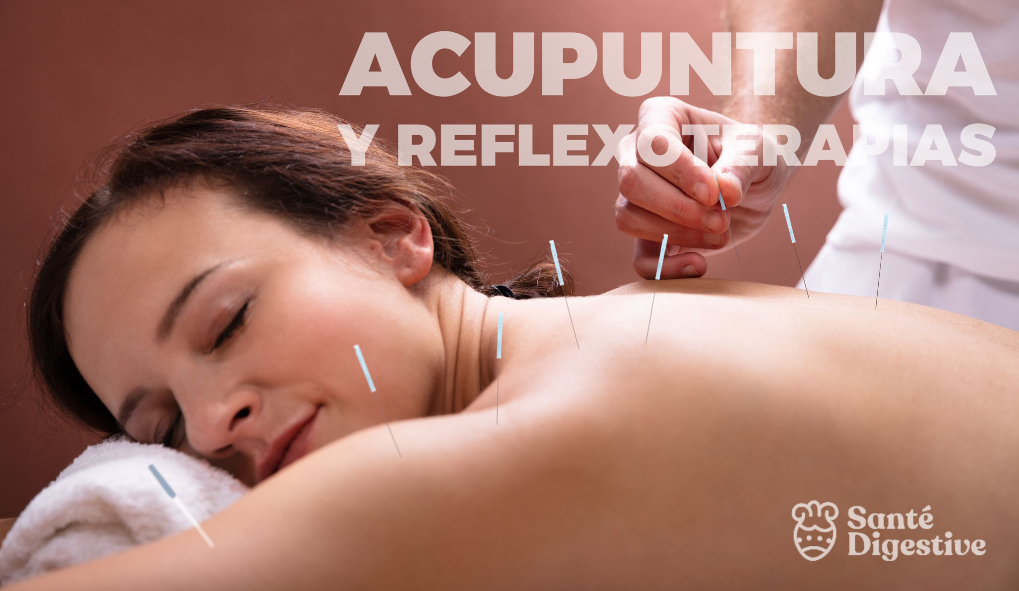 Acupuntura en Sante Digestive