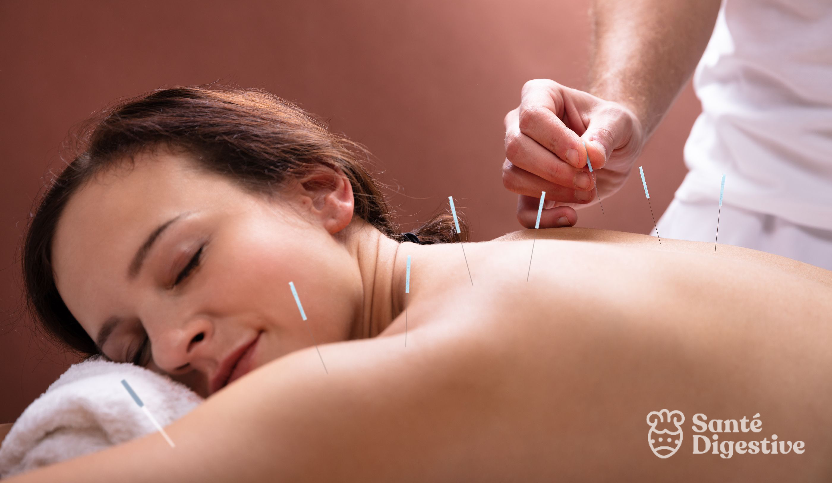 aCUPUNTURA EN sANTE dIGESTIVE